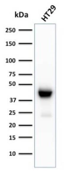 Cytokeratin 20 Antibody (KRT20/3129R) - Azide and BSA Free, Novus Biologicals 100 &mu;g | Buy Online | Novus Biologicals | Fisher Scientific